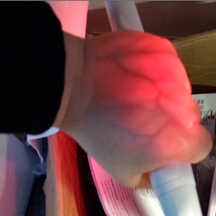 感应款血管显像仪红外静脉显示仪输液神器查找仪穿刺护士照血管灯