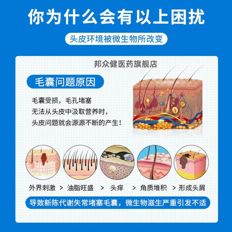 屑康王酮康挫清洁头皮去屑止痒抑菌洗发水清爽控油洗发露750375