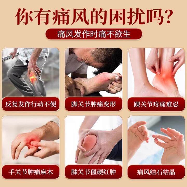 协医生穴位压力刺激贴-关节肿胀、疼痛、痛风、高尿酸官方旗舰店5