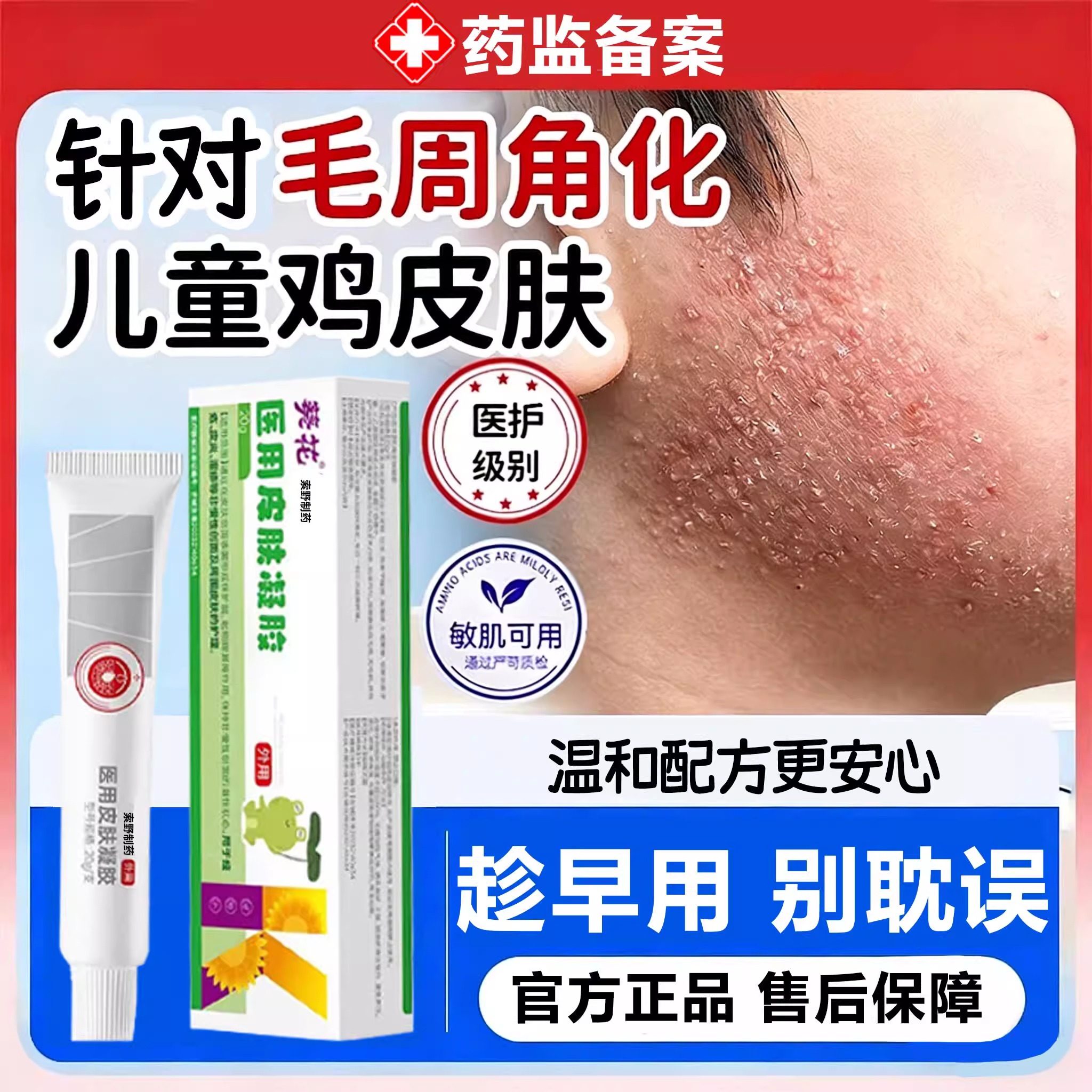 儿童毛周角化症鸡皮肤袪除脸颊两边小颗粒祛毛囊炎起小疙瘩Y7