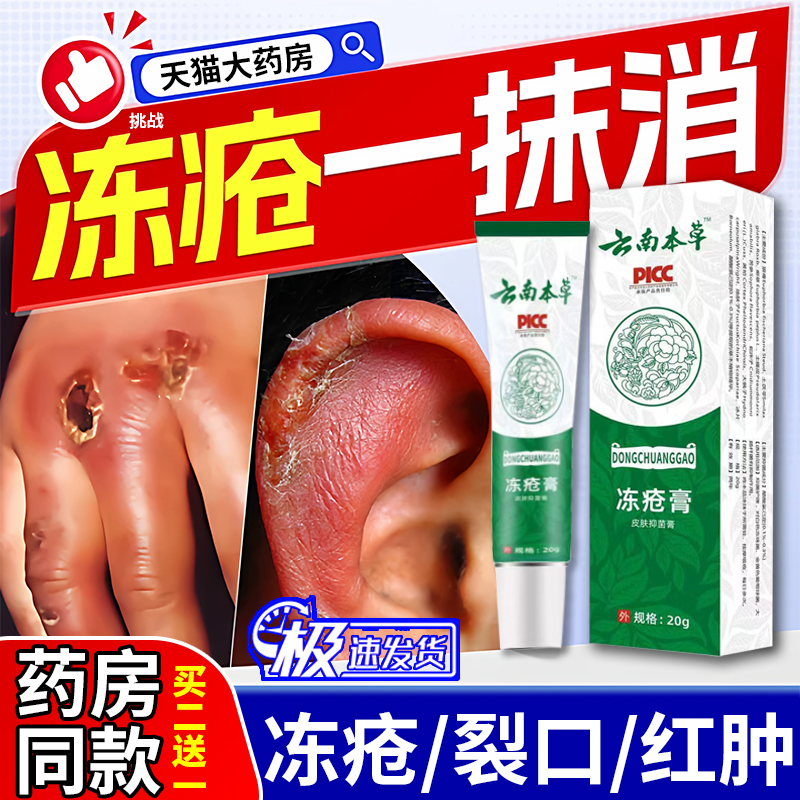 【冻疮膏】手足部裂开红肿热销中