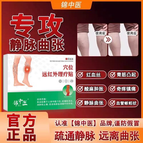 锦中医静脉曲张型远红外骨痛贴青筋凸起膏贴药官方旗舰店正品MT