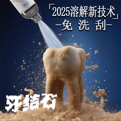 【爆款断货王】牙石溶解漱口水洗牙齿污垢牙垢牙黄牙渍清理神器