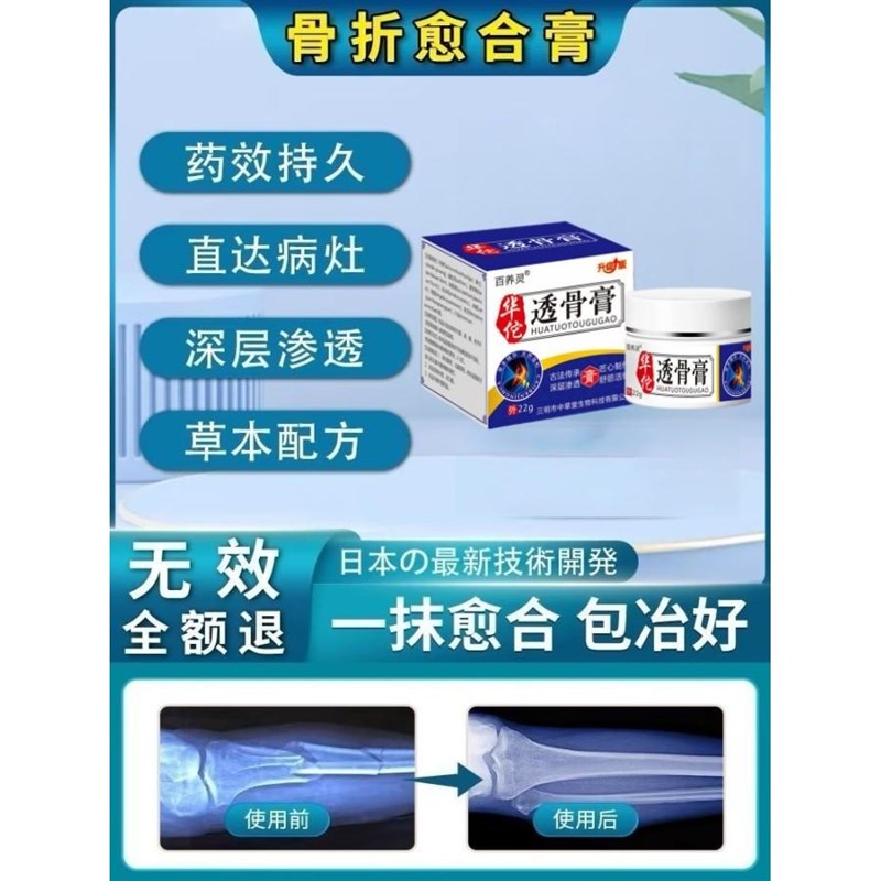 骨折骨裂恢复跌打损伤活血化瘀伤筋动骨消肿止痛全身可用