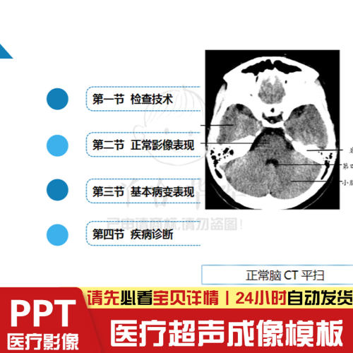 医疗影像学造影成像超声成像检查技术培训教学课件PPT模板素材