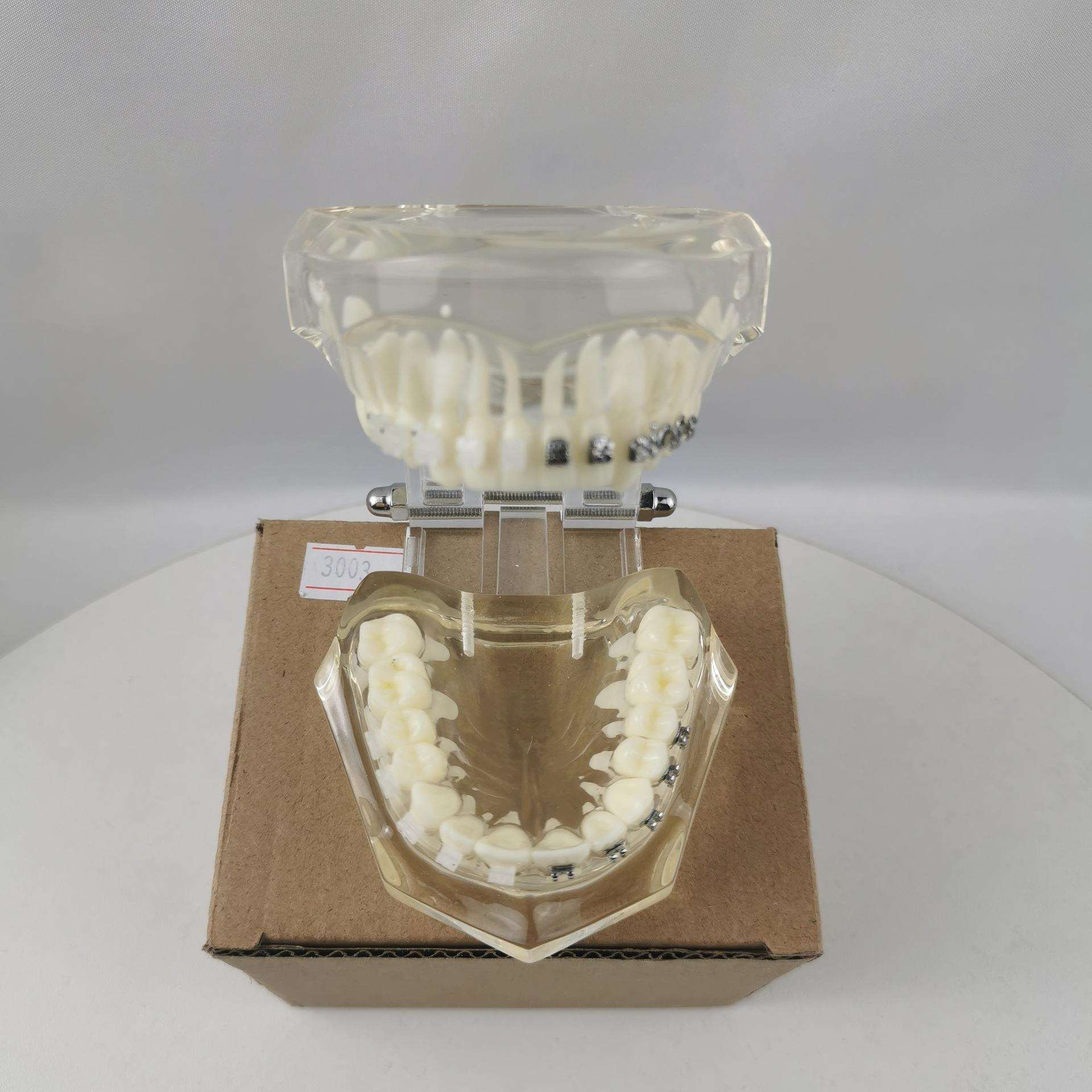 M3003半金属半陶瓷托槽演示牙齿模型
