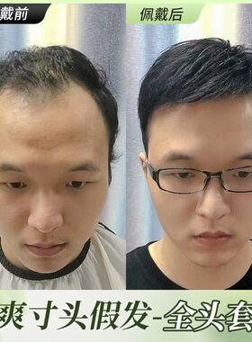 现货男士假发男生头套p夏天薄款真发短发男款真发丝男式假发套免