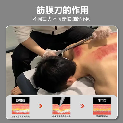 筋膜刀大m刀专业级肌肉肌膜松解按摩316不锈钢刮筋颈膜刀送按摩膏