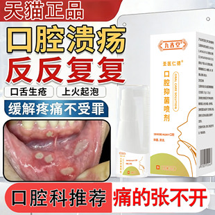 口腔溃疡药物反复用一点灵膏疡膜贴舌头修复液抑菌杀菌上火起泡hr