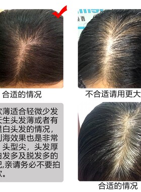 真发补发头顶f假发片女手织刘海片真人发丝隐形无痕超薄迷你补发