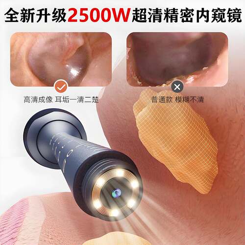 EM定制朵可视掏耳勺高清挖耳勺带镊子O掏耳器采耳S1pro工具神套装