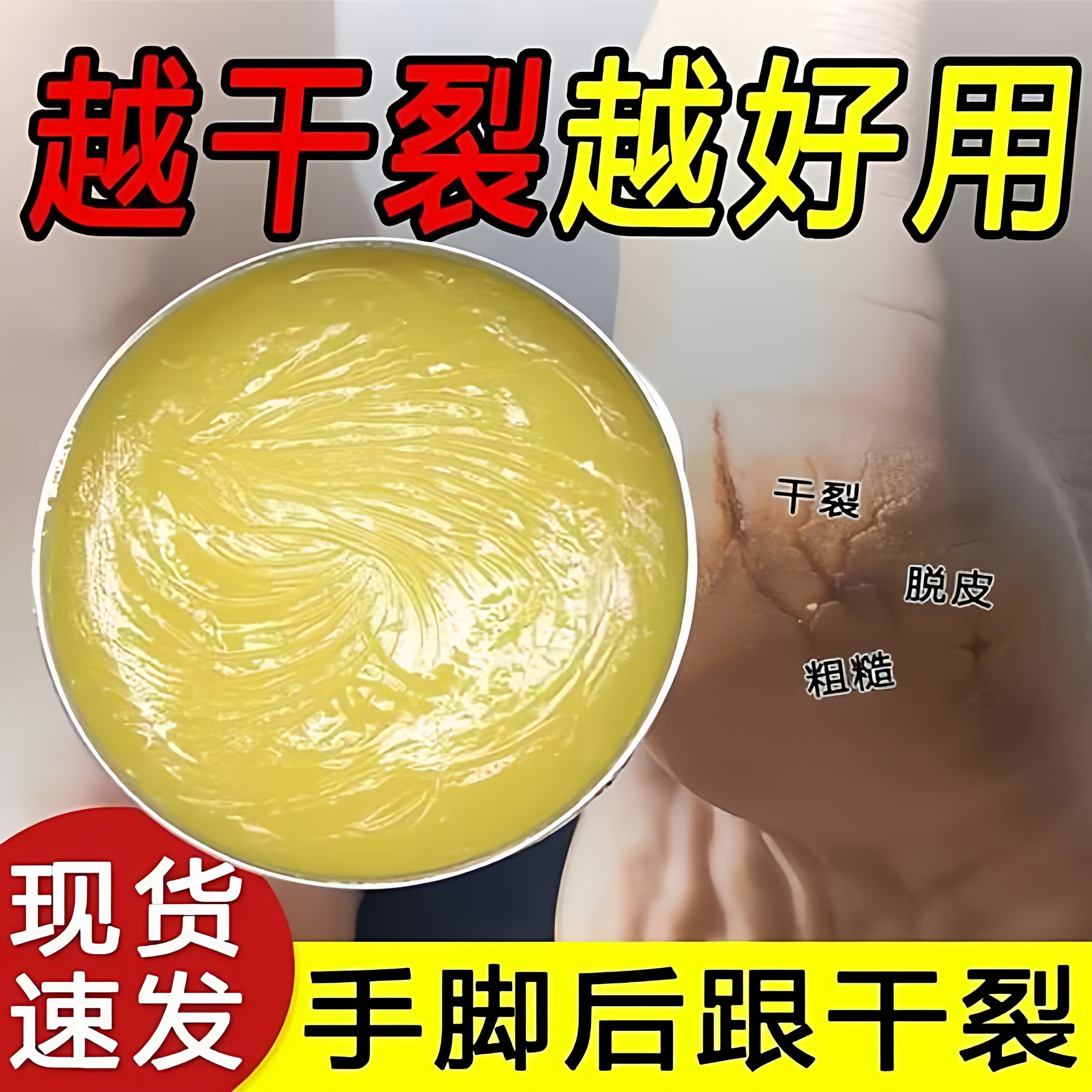 手足脚后跟干裂足霜手脱皮起皮滋润补水护手霜开裂干燥硬皮脚跟