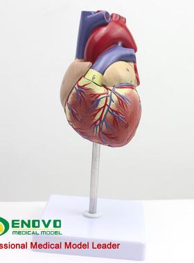 颐诺E医N239OVO1:1人内体心脏解剖模型彩超心心科生礼品脏教具