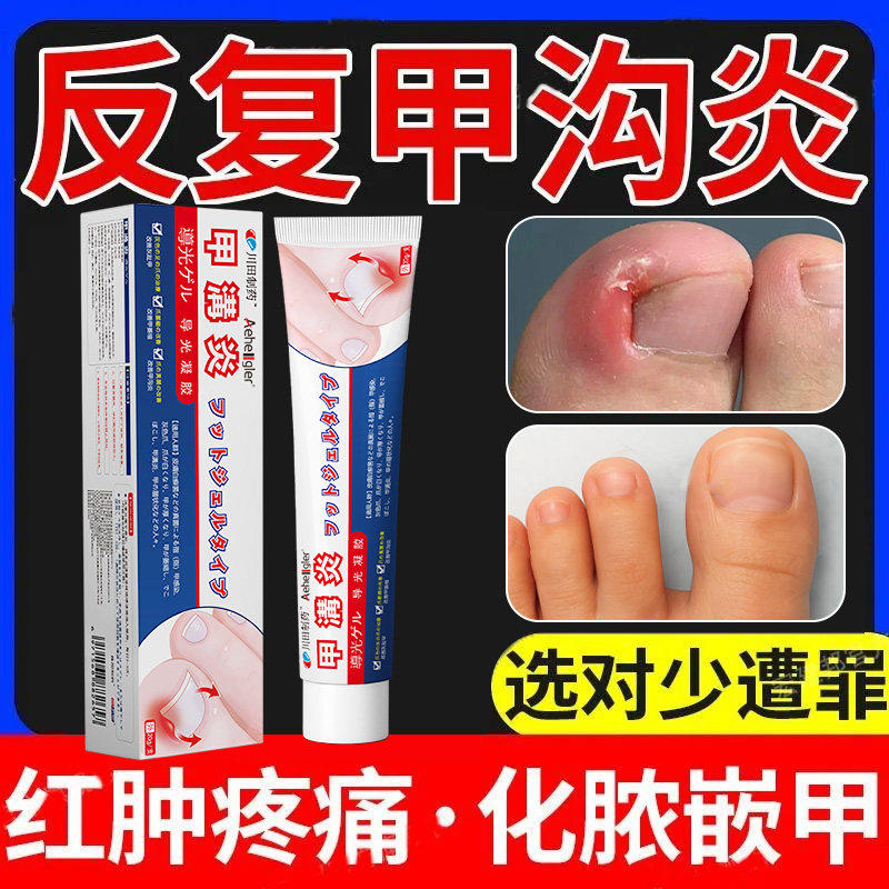 甲沟炎专用膏嵌甲抑液正品官方旗舰店