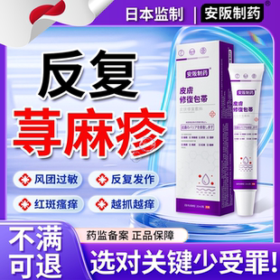 反复寻荨麻疹过敏止痒风团红斑瘙痒肿胀急慢性热寒性药膏凝胶KY