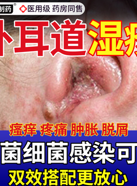 外耳道湿疹耳朵干燥起皮真菌感染耳朵发炎流脓药膏可搭滴耳液SJ
