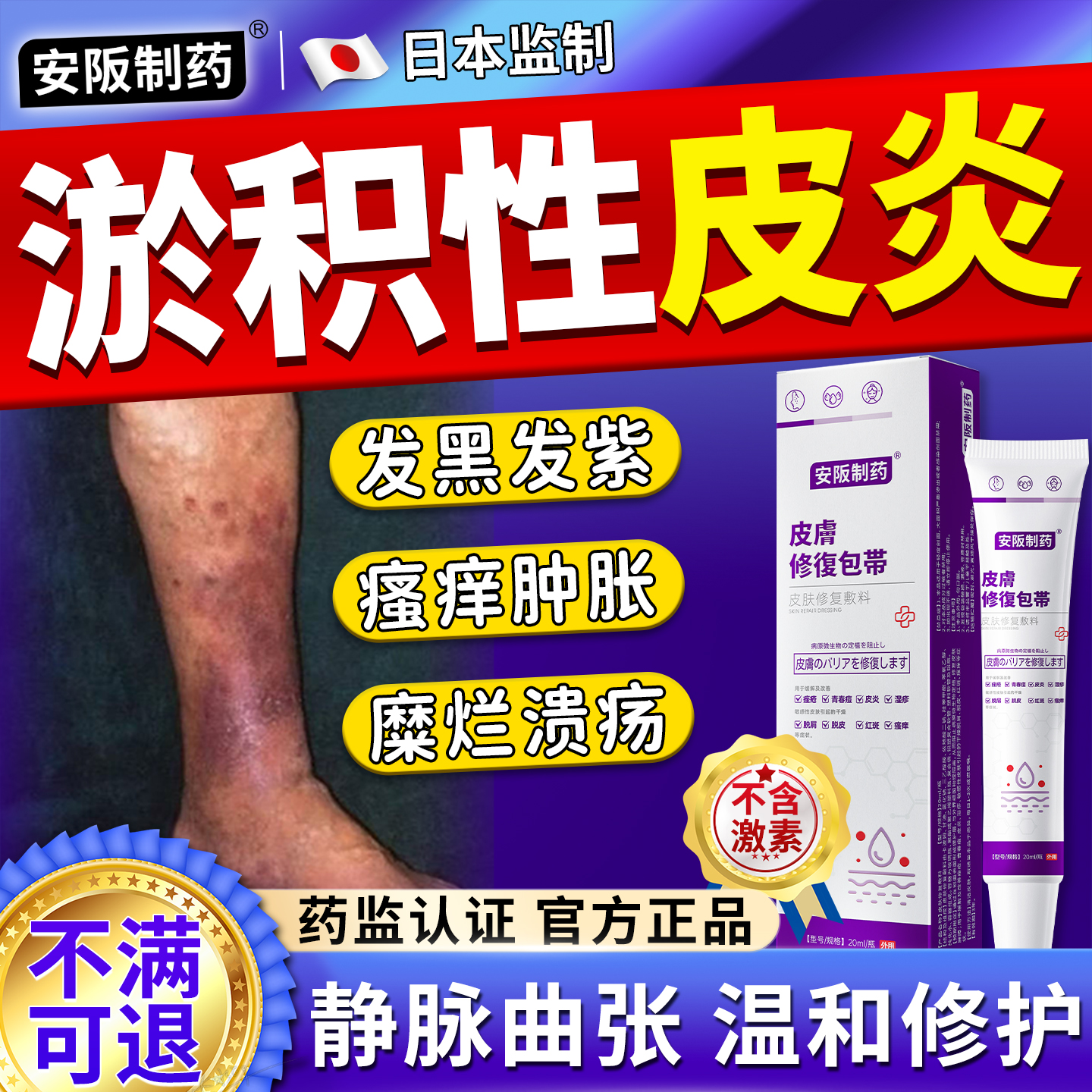 小腿肿胀 发黑发紫 瘙痒难耐 破败糜烂