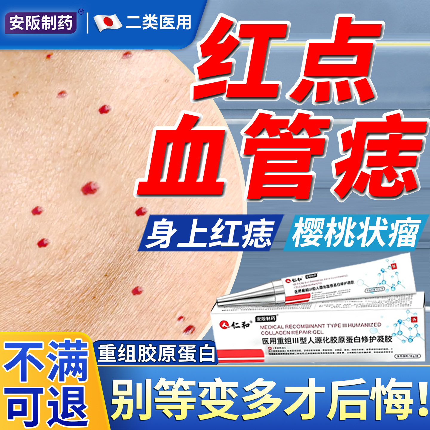 血管痣去除手臂小红点樱桃状血管瘤点红痣蜘蛛痣去身上黑疙瘩药膏