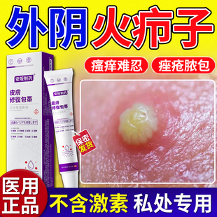 外阴火疖子疖肿拔毒膏皮脂腺囊肿私处脓包硬块拔脓敷料贴KY