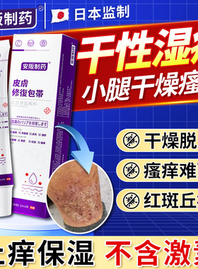 干性湿疹小腿秋冬天皮肤干燥瘙痒起皮止痒专儿童顽固皮炎外用膏KY