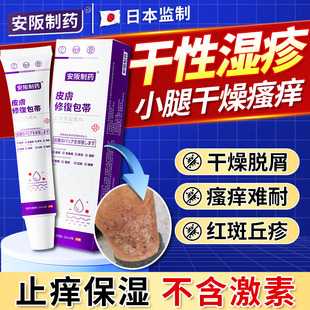干性湿疹小腿秋冬天皮肤干燥瘙痒起皮止痒专儿童顽固皮炎外用膏KY