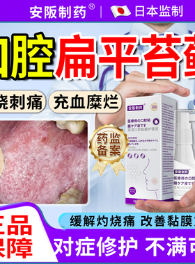 口腔扁平苔癣藓专口腔白斑黏膜纤维化用修复舌头口腔溃疡喷剂药KY
