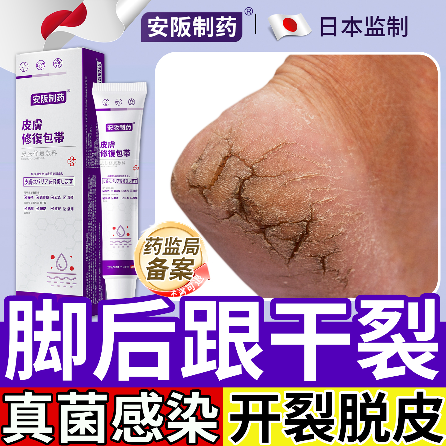脚后跟干裂真菌感染修复药膏