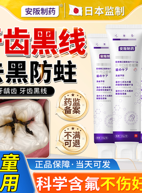 去除牙齿黑线黑渍牙窝沟专用神器牙膏防蛀牙龋齿修复防龋凝胶KY