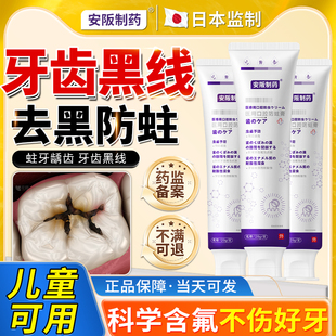 去除牙齿黑线黑渍牙窝沟专用神器牙膏防蛀牙龋齿修复防龋凝胶KY