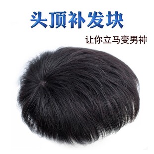 假发男短发头顶补发片真发男士假发帅气韩版隐形无U痕男式真发补