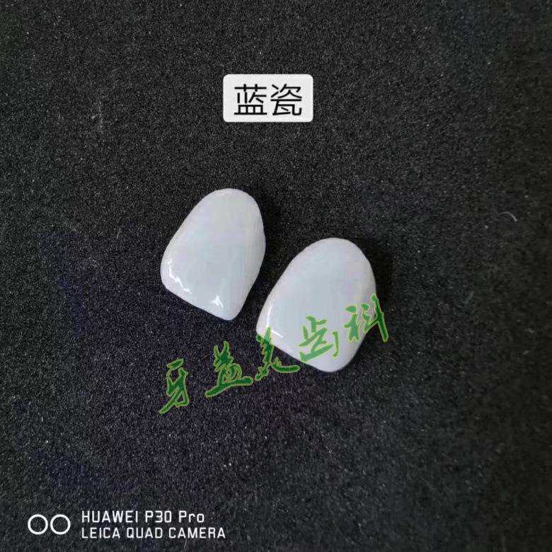冰瓷牙全瓷贴面蓝瓷 较薄牙贴片牙釉质 贴片厂家直供