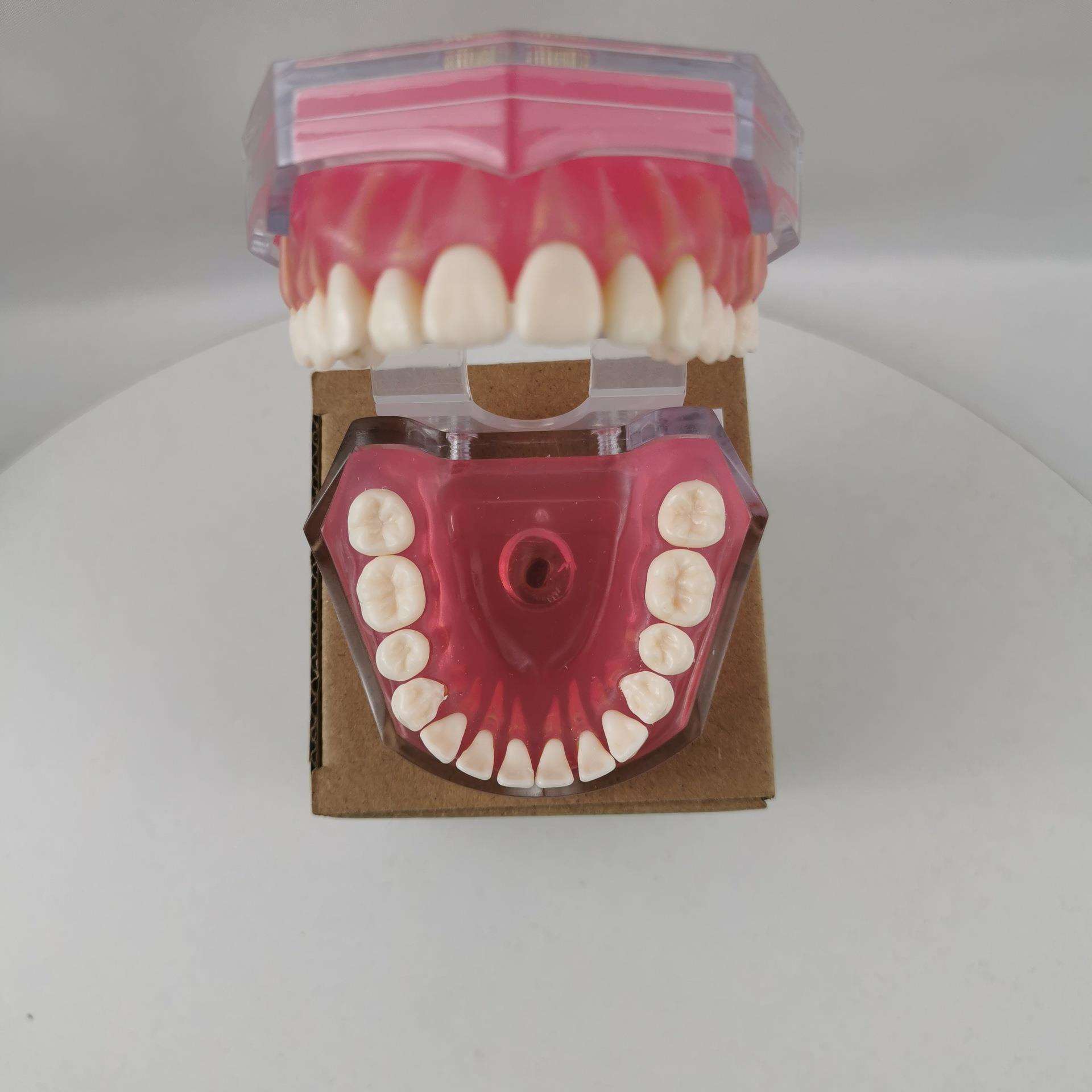 M7008成人可拔牙模型 软牙龈模型 软牙龈拔牙模型