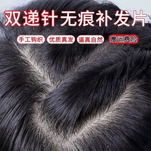 双递针假发片头顶补发片女真发遮白发自然蓬N松增发量隐形无痕补