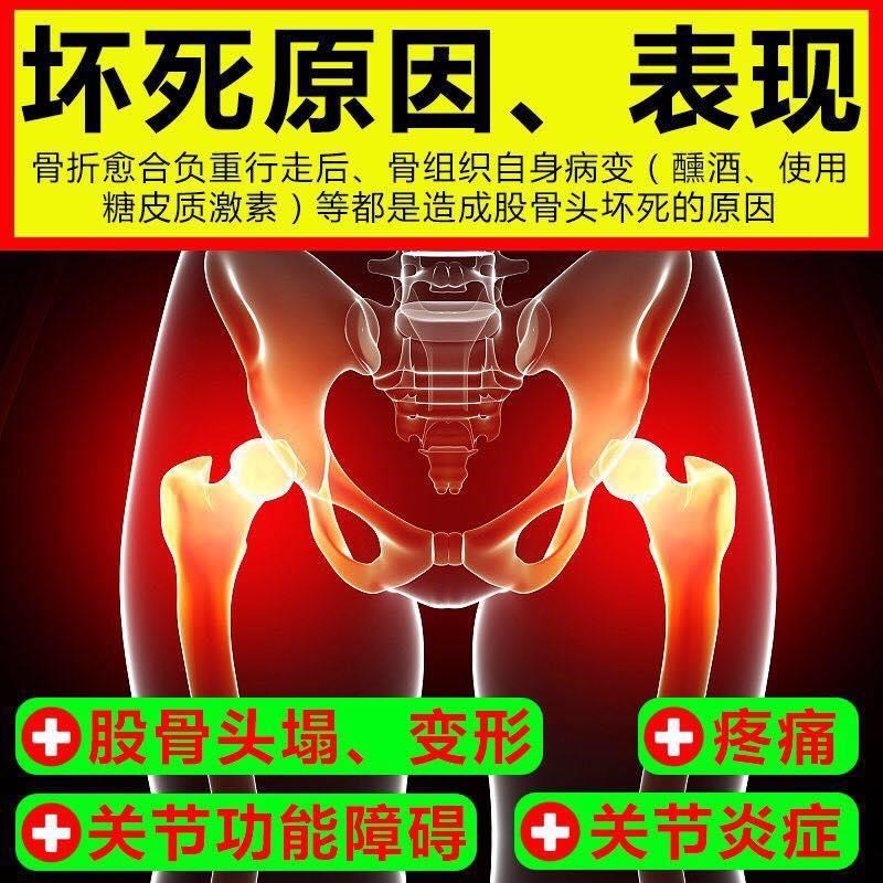 股骨头疼痛贴髋关节坏死大腿屁股疼骶髂尾椎塌陷膏贴