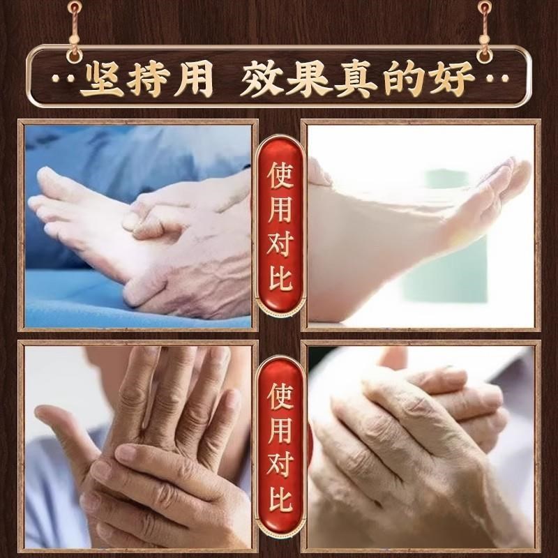 手脚麻木贴四肢发麻颈腰椎压迫神经四肢手臂无力酸麻酸疼痛专用膏