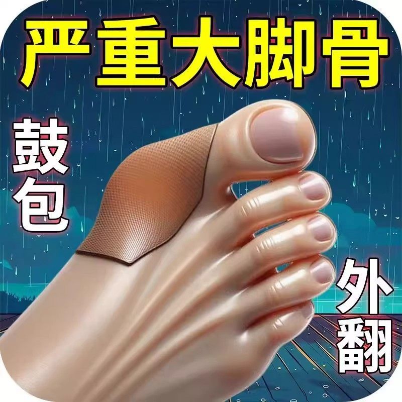 【已愈100万人】拇外翻贴脚趾重叠防磨大脚骨外翻专用膏贴