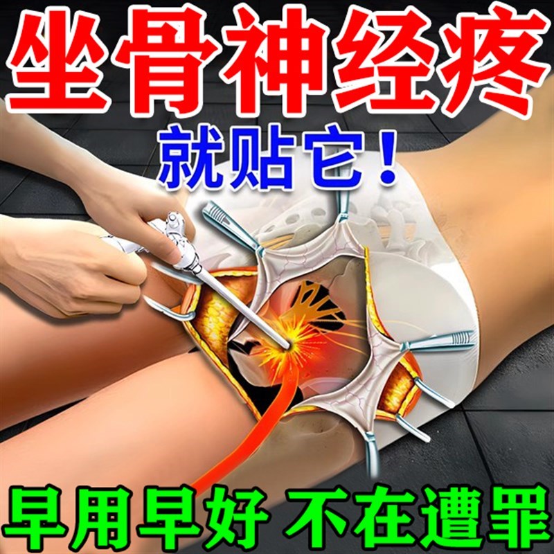 就贴它】坐骨神经痛贴腿麻屁股腰压迫坐骨神经疼药膏药通络膏药贴