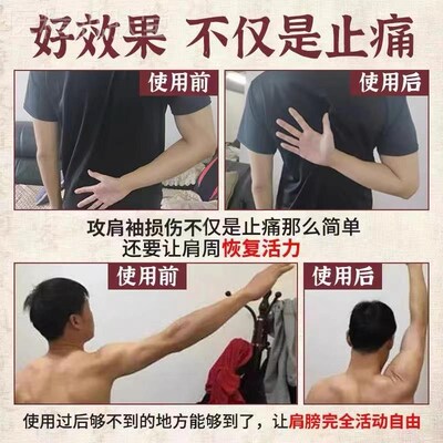 严重肩周焱专用【包冶好】肩膀疼痛抬臂困难怕冷肩周消焱止痛膏贴