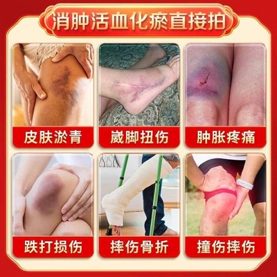 消肿活血散瘀外用马膏跌打损伤化瘀舒筋止痛摔伤磕伤筋动骨膏药