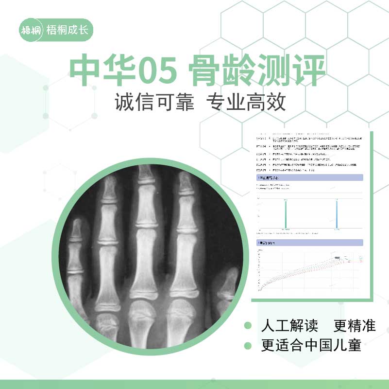中华05骨龄片解读影像鉴定人工专业儿童青少年身高长高指导