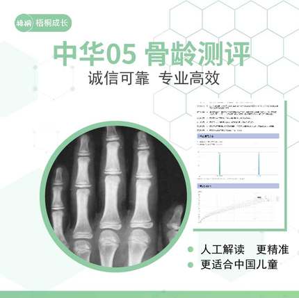 中华05骨龄片解读影像鉴定人工专业儿童青少年身高长高指导