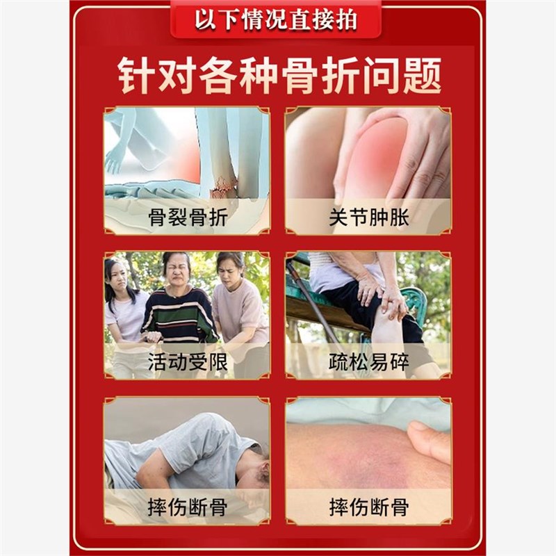 骨折骨裂接骨续筋膏药快速接骨愈合恢复活血化瘀跌打损伤专用膏贴