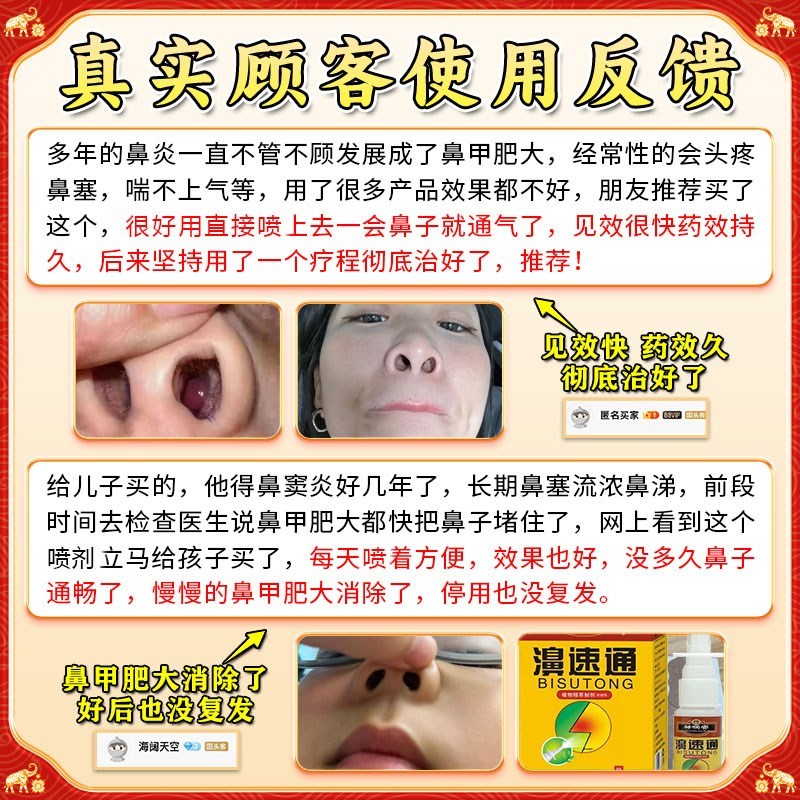 鼻甲肥大专用特效药消炎修复消肿喷雾剂儿童鼻窦炎中药通鼻塞神器