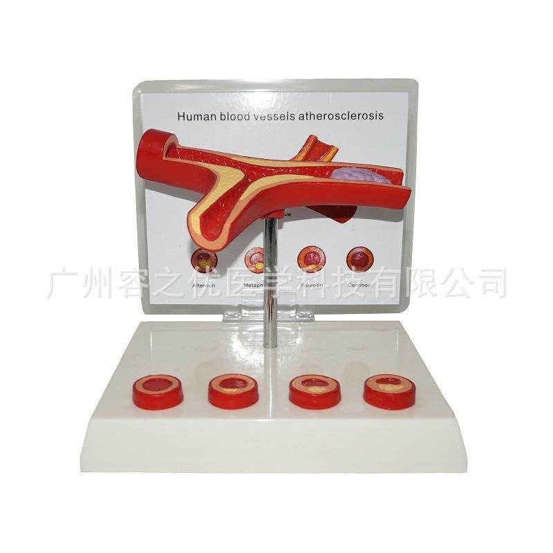 血管模型人体心血管模型教学模型