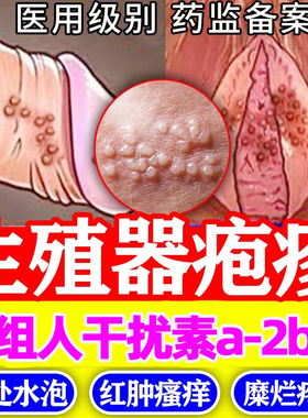重组人干扰素a2d软膏人工干扰素ab2冷敷抑菌凝胶喷雾剂b2乳膏YY