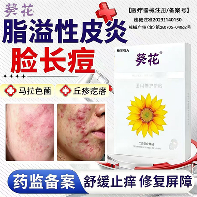 脂溢性皮炎面部鼻子两侧泛红马拉色菌医用修复贴脸颊过敏起皮膜FZ