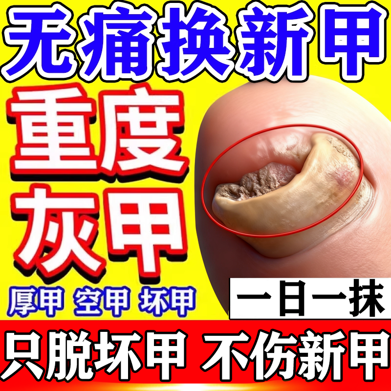 【金归】环吡酮胺乳膏1%*20g*1支/盒