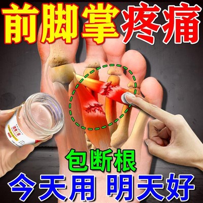 前脚掌疼痛贴脚底板疼痛肌肉韧带拉伤足底筋膜炎热敷神器专用药膏