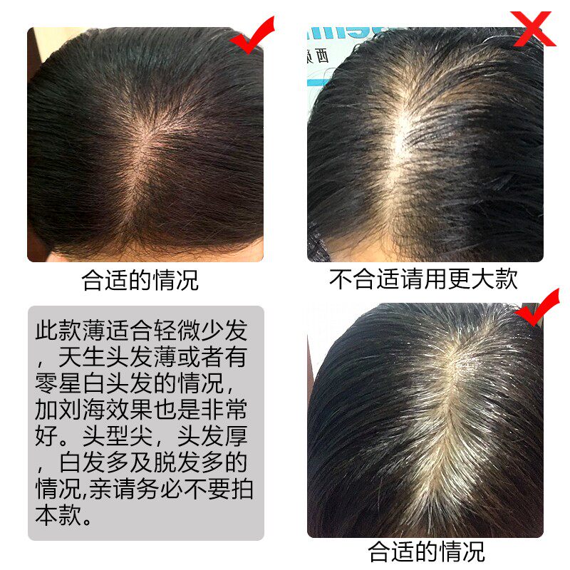真发补发头顶假发片女手织刘海片真人发丝隐形无痕超薄迷你补发块图片