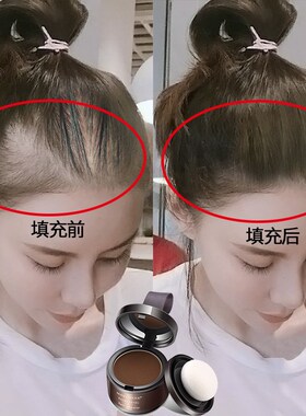 发际线粉呗呗兔分画头发后移少头皮遮盖填充补涂棒笔补发修容神器